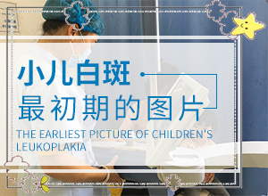 白班早期癥狀圖片[有什么癥狀呢]白癩風(fēng)初期有多大