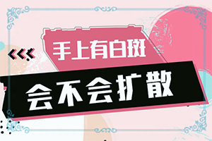 白點(diǎn)癲風(fēng)如何治療了[哪些問題能治]兒童白癩癜風(fēng)能治好嗎