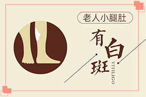 怎樣治療白癲瘋,如何治療好(對白癜風(fēng)的治療有幫助嗎)