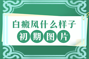 5歲的孩子臉上有白斑是怎么了,哪些原因誘發(fā)呢(患發(fā)是什么原因)