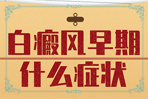 白癩風那里有得治療[怎么更好治療]白癲瘋手上能嗎