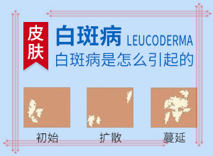 早期白癩風的圖片,表現(xiàn)癥狀是啥(怎么判斷)