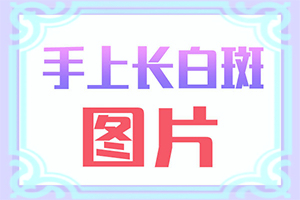 哪家醫(yī)院治療白癜風好[治療的方式是什么]得了白哪里治