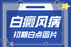 脖子周圍長白斑什么原因-什么原因會誘導(dǎo)白斑