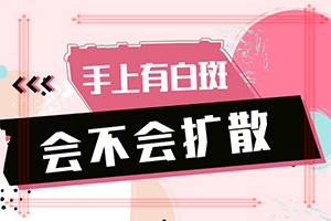 白癩風(fēng)的早期圖一片,有哪些癥狀需要知道(會有什癥狀)