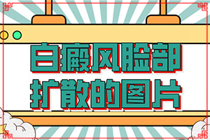 頭部白癜風有什么癥狀,發(fā)現(xiàn)白點該怎么辦(哪些癥狀可以判斷)