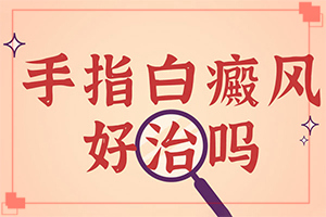 白點(diǎn)癲風(fēng)怎么治-[解決方案]擦什么藥膏見效快