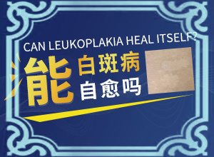 兒童臉上起白斑是缺少維生素嗎,因?yàn)槭裁椿忌?病情加重是因?yàn)槭裁?