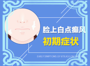 為什么會白殿風(fēng),導(dǎo)致的因素有哪些(白斑的因由是哪些)