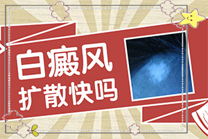 皮膚有白斑塊怎么回事[癥狀圖片對(duì)比]腿上出現(xiàn)白班