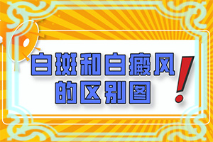怎樣區(qū)分白斑和白癩風(fēng)[主要區(qū)別是什么]白癲瘋是什么癥狀？