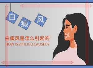 白瘋顛初期的圖片,不同時(shí)期發(fā)病時(shí)病癥(診斷應(yīng)該怎么做)