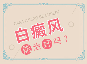 白癲風(fēng)初期圖片[會(huì)給帶來什么危害]初期白顛圖片