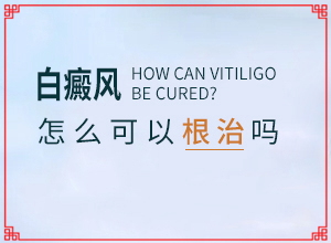 白癜風(fēng)的誘因如何檢查出來(lái)-具體的誘因有哪些