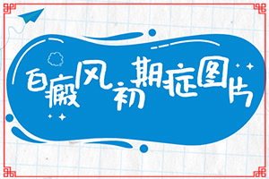 臉上長白班怎么辦[診斷步驟有哪些]白癩風(fēng)初期什么樣子