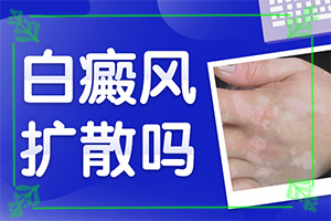 白瘋顛怎么治療[可以用什么來治療]兒童白癩風(fēng)能治好嗎