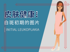 白癩風是如何引起的,哪些緣由導致(幾大病因是什么)