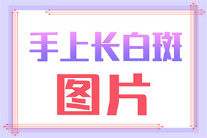 白癩風(fēng)的圖片,癥狀圖片對(duì)比(什么變化)