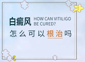[治療效果如何]白癩風病可以根治嗎