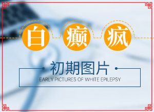 初期白癲能嗎[主要癥狀什么樣]白殿病初期癥圖片