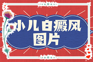白癩風(fēng)可以治療好嗎？有什么土方法嗎（診療白斑這些是關(guān)鍵）