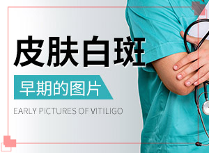 長(zhǎng)白殿風(fēng)是什么原因-男生私密處出現(xiàn)白斑是怎么回事