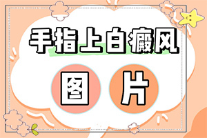 白殿病初期圖片[不同時期的癥狀]輕微白癩風(fēng)圖片