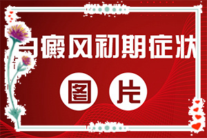 白顛風(fēng)早期圖片,怎么判斷(如何自己診斷)