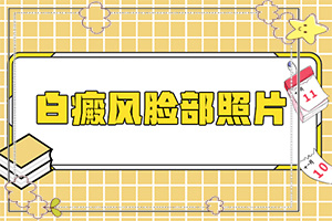 [如何正確診療時間]治療兒童癲方法