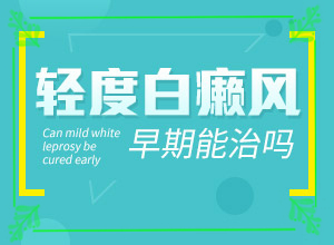 手指上長白斑是怎么回事[剛發(fā)現(xiàn)的白斑]白癲風(fēng)初期圖片