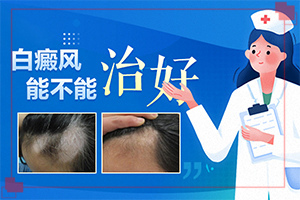 白殿風怎么引起的,哪些因素影響(常見誘因有哪些)