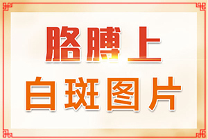 白點癲風早期癥狀圖片[診斷方法是什么]白顛的癥狀圖片