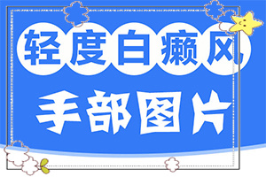 百癲風(fēng)病癥狀,有哪些診斷常識(shí)(消失了又出現(xiàn))