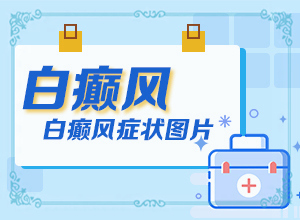 白癲瘋是什么癥狀？[白斑病情有哪些癥狀]手指上白癲風(fēng)