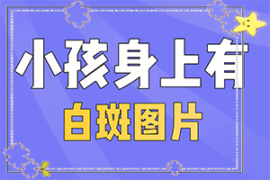 白瘋癲初期癥狀圖片,有哪些癥狀表明出現(xiàn)嚴重情況呢(光滑的白斑是嗎)
