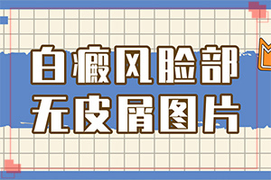白癩風的圖片[如何辨別]白廣癲瘋圖片