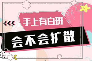 肛門白斑有什么藥可以治[常見癥狀是什么樣的]白顛初期癥狀