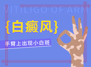 缺微量元素的小孩臉上有白斑嗎,病因由來是哪些(得白癜風(fēng)的概率)