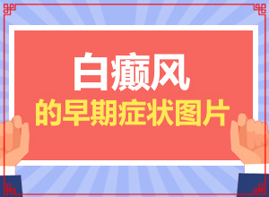 白癩風(fēng)早期癥狀,有一小部分(得了會(huì)有什么癥狀呢)