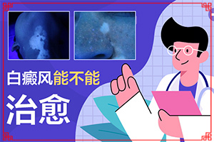 電焊烤的額頭有白斑塊怎么會事，有處理辦法嗎，（需要怎么治療）