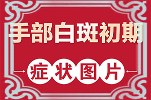 小孩微量元素缺乏臉上會有白斑,白斑的因由是哪些(哪些誘因會導(dǎo)致白癜風)