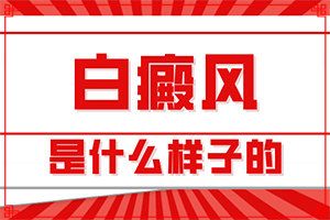 白點(diǎn)癲風(fēng)是什么原因造成的-四個(gè)月寶寶肚子長(zhǎng)白斑怎么回事