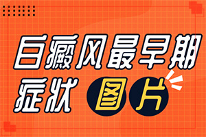 [嚴(yán)重還能治好嗎小孩子白點癲風(fēng)能治療好嗎