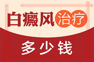 孩子臉上張白斑怎么回事[診斷方法是什么]皮膚白班早期圖片