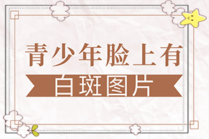 白斑和白點癲風的區(qū)別,癥狀表現(xiàn)特點是(有什么不同之處)