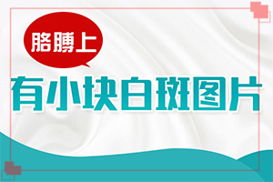 白點(diǎn)癲風(fēng)怎樣治[如何調(diào)節(jié)控制]治療兒童白斑需要多少錢