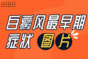 [醫(yī)生詳解]臉上白癜風(fēng)初期是什么樣子的-臉部白癜風(fēng)初期圖片