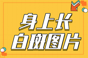 怎樣治療白癲瘋,如何治療好(對白癜風(fēng)的治療有幫助嗎)