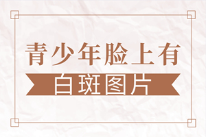 [熱門(mén)討論]青少年患上白癜風(fēng)的原因有哪些-是什么讓青少年也患上白癜風(fēng)疾病