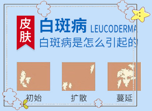 皮膚上出現(xiàn)白斑(全面檢查哪些癥狀)